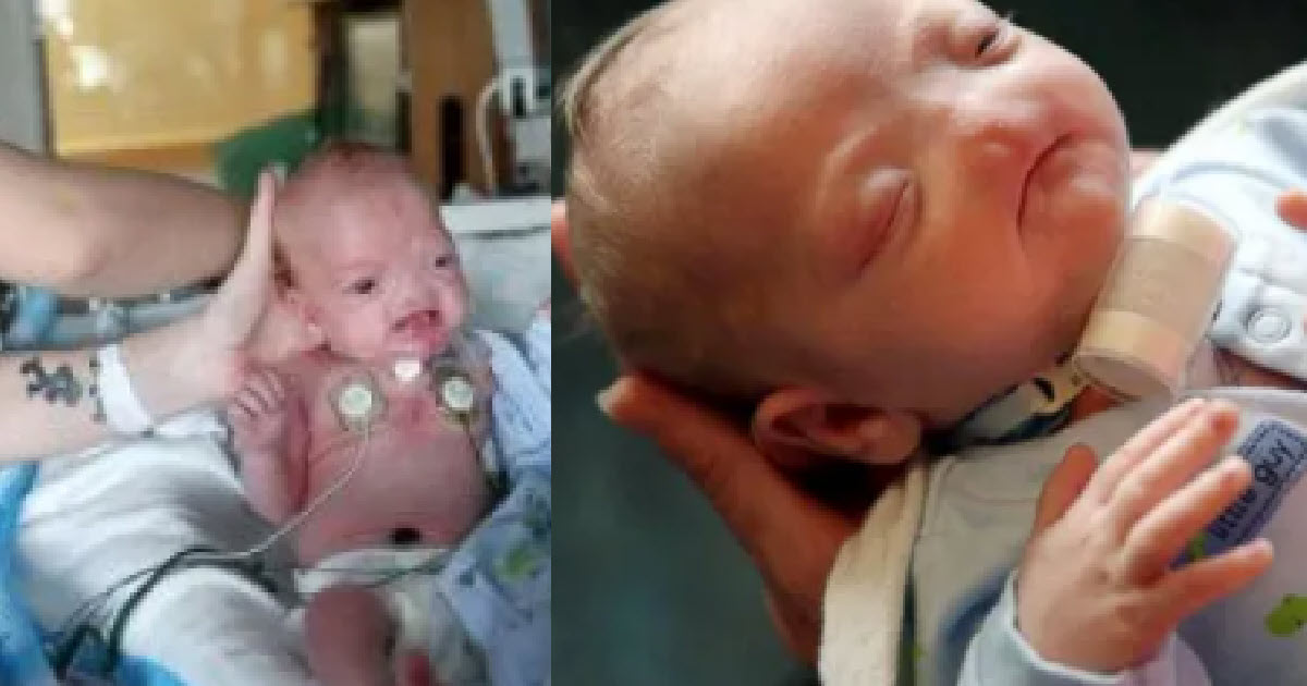 Mom Who’s Baby Was Born Without Nose Says He’s Perfectly Healthy, Happy, and Cute
