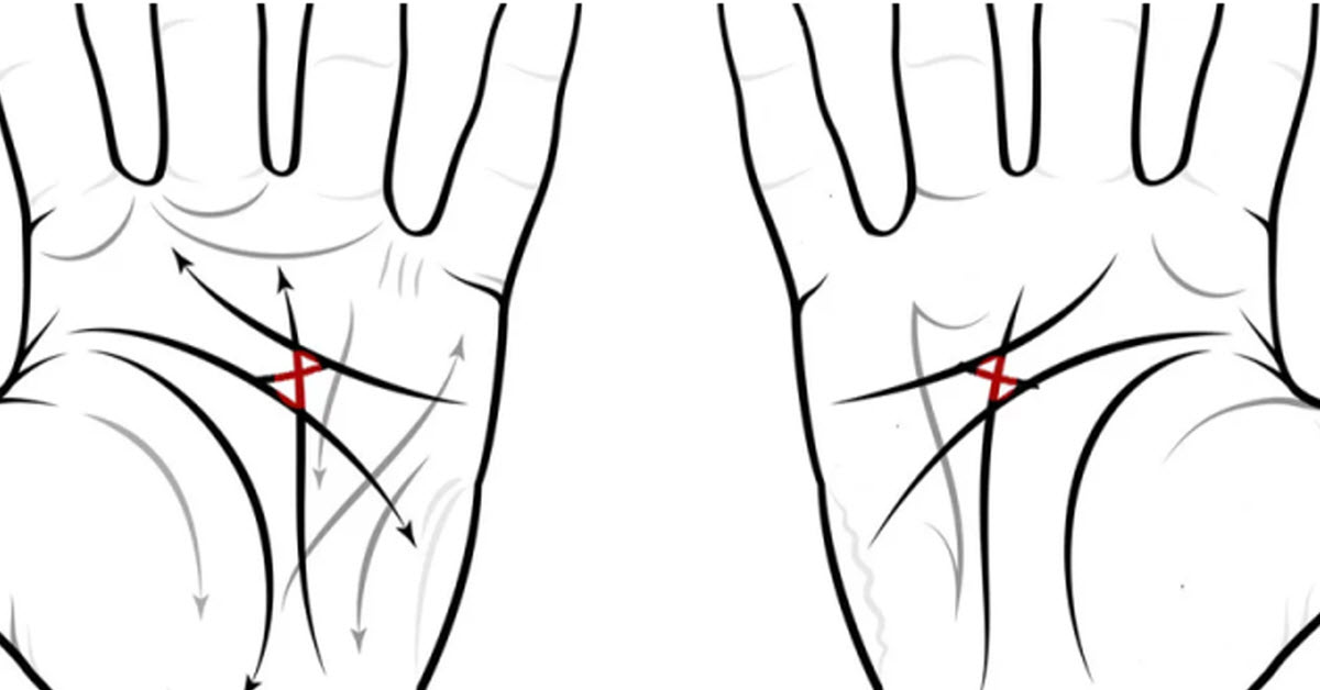 Do You Have The Mystery X On Your Palms? What Could It Mean?