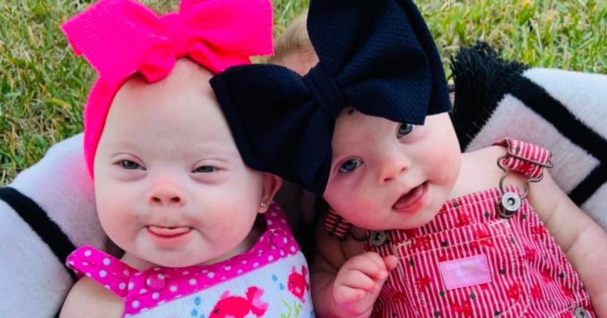Woman Gives Birth To Rare Twins – Identical And Both With Down Syndrome