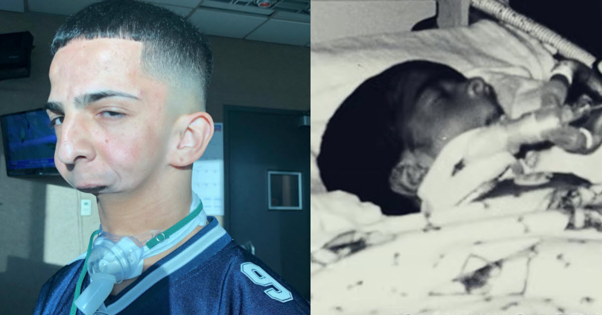 Parents Were Told Their Baby Wouldn’t Survive Without A Jaw But Look At Him Now